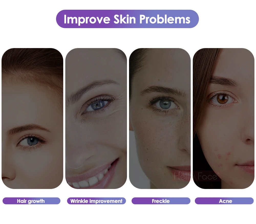 Mesotherapy Microneedle Pen