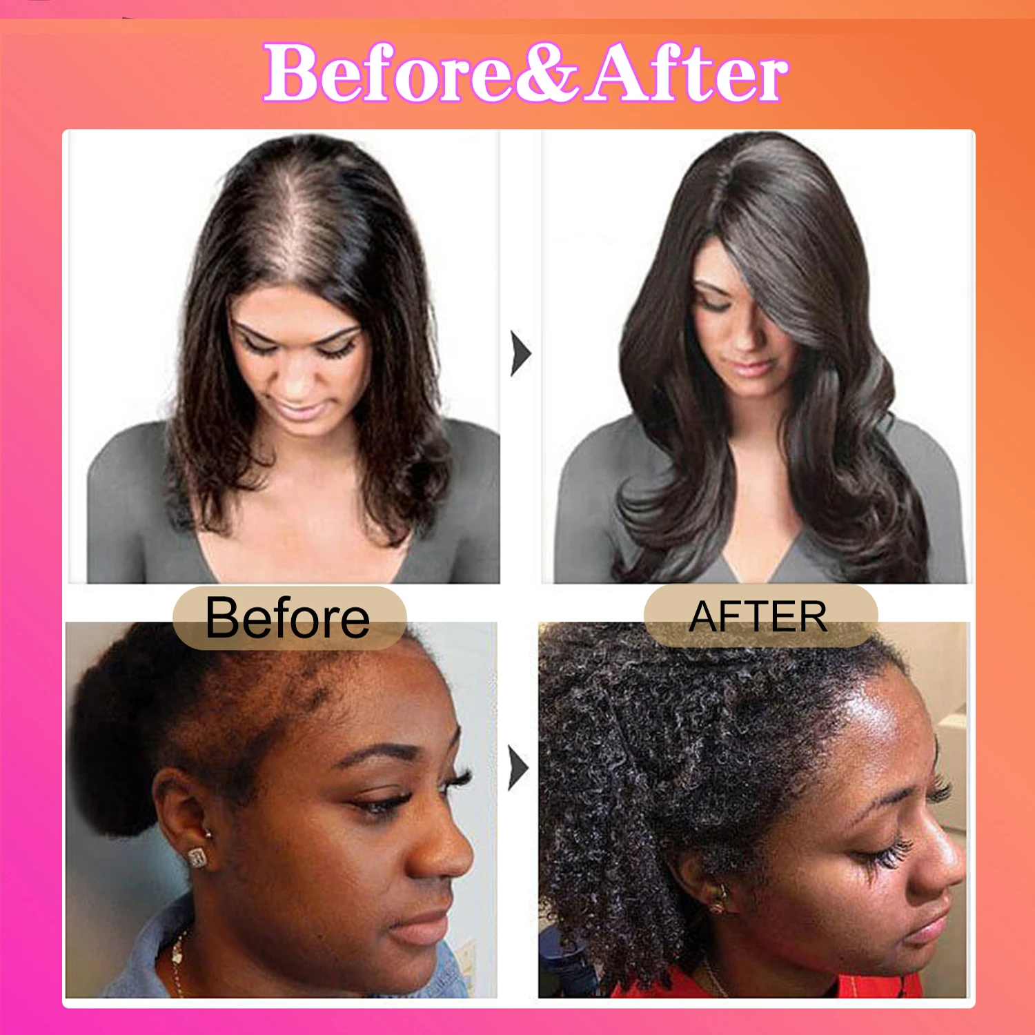 Original Batana Oil – Boost Hair Growth,Repair Naturally & Nourish - Image 2