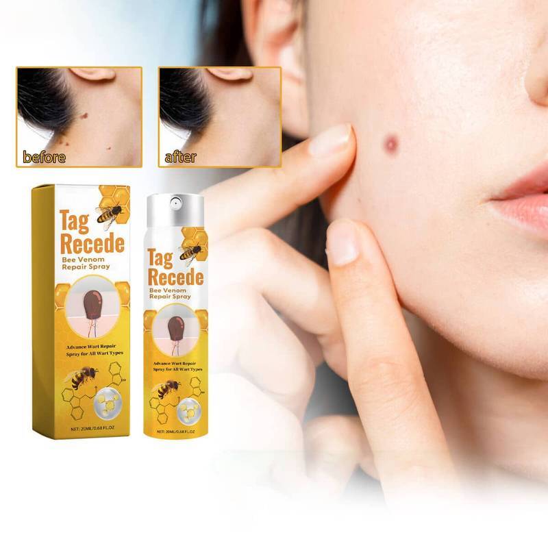 Skin Tag Removal Spray