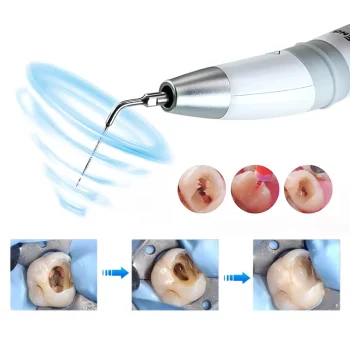 Dental-Ultrasonic-Remover-Electric-Sonic-Teeth-Plaque