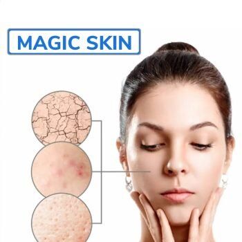Glycolic Acid Peel results