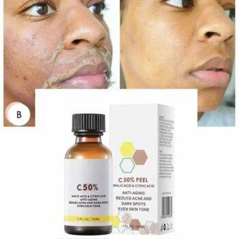 Peel Serum